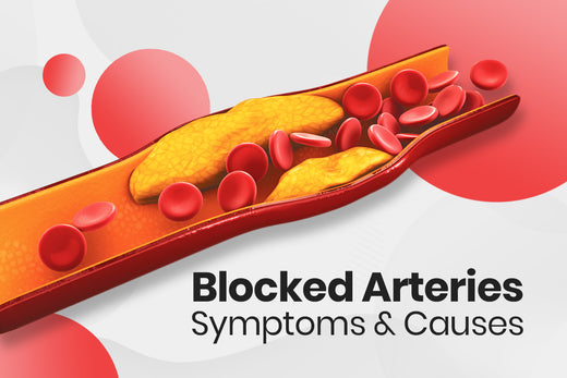 Blocked Arteries Symptoms