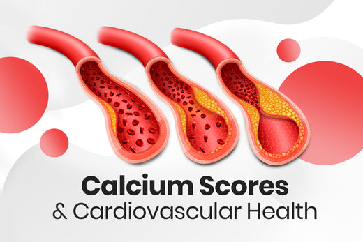 Understanding Calcium Scores