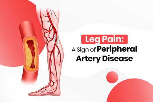 Leg Pain A Sign Of Peripheral Artery Disease