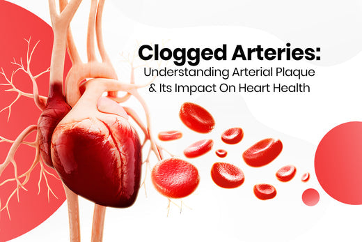 Clogged Arteries: Understanding Arterial Plaque and Its Impact on Heart Health