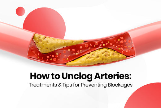 How to Unclog Arteries: Treatments and Tips for Preventing Blockages