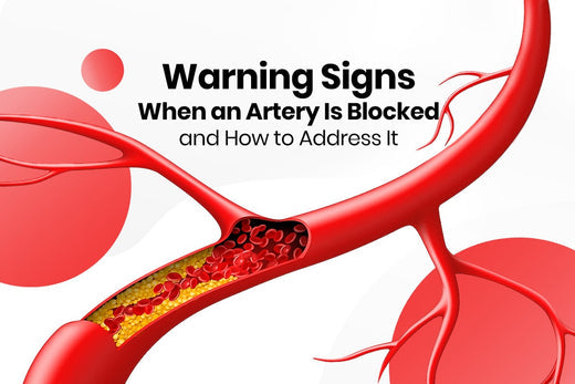 Warning Signs When an Artery Is Blocked and How to Address It