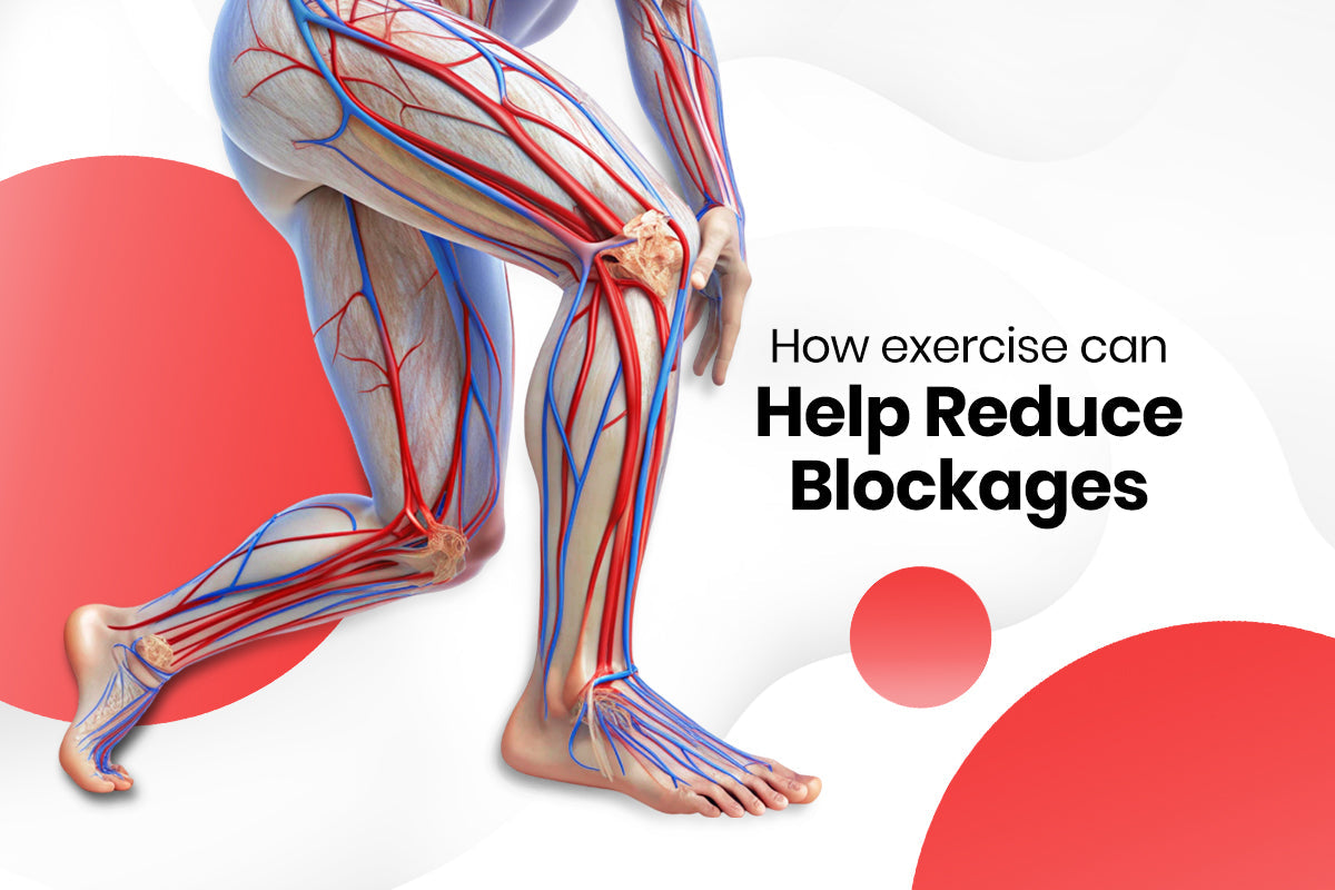 Move to Unclog Your Arteries: How Exercise Can Help Reduce Blockages