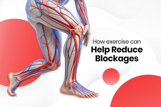 Move to Unclog Your Arteries: How Exercise Can Help Reduce Blockages