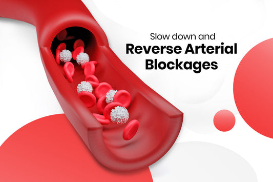 Slow and Reverse Arterial Blockages—One Step at a Time